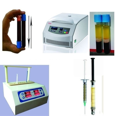 6/8x15ml পোর্টেবল PRP সেন্ট্রিফুগ ডিভাইস 0-4000rpm কসমেটিক সার্জারি হাসপাতালের জন্য